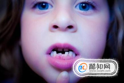 儿童乳牙还没掉恒牙就长出来了怎么办？